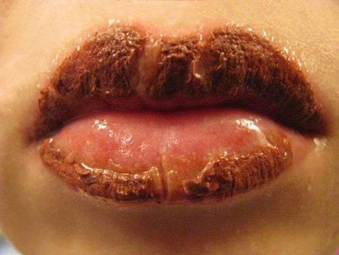 Хворобливий процес татуажу губ (7 фото)