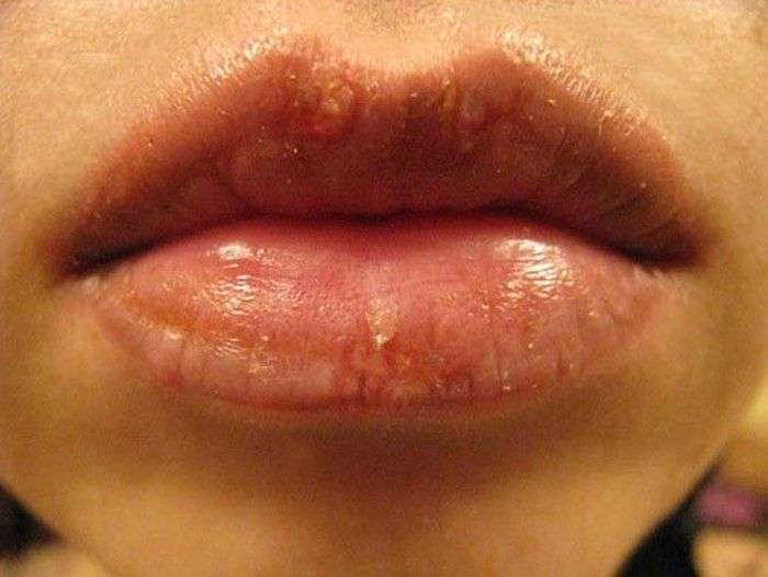 Хворобливий процес татуажу губ (7 фото)